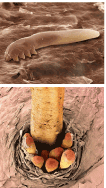 デモデクス